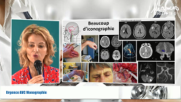 Urgences AVC Monographie