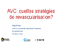 Urgences neuro-vasculaires - Quelles stratégies de revascularisation ?