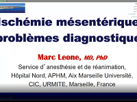 Urgences vasculaires digestives