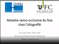 Urgences vasculaires digestives