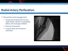 USC Discussion 2021: Radial Artery Complications USC Discussion 2021: Radial Artery Complications