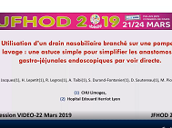 Utilisation dun drain nasobiliaire branché sur une pompe à lavage : une astuce simple pour simplifier les anastomoses gastro-jéjunales endoscopiques par voie directe