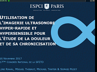 «Utilisation de l’imagerie ultrasonore hyperrapide et hypersensible pour l’étude de la douleur et sa chronicisation» «Utilisation de l’imagerie ultrasonore hyperrapide et hypersensible pour l’étude de la douleur et sa chronicisation»