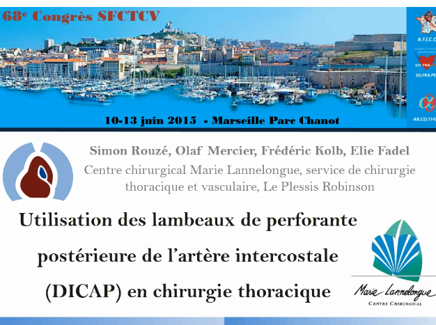 Utilisation de lambeau perforant de l'art intercostale postérieure en chirurgie thoracique Utilisation de lambeau perforant de l'art intercostale postérieure en chirurgie thoracique