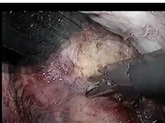 V036: M Hamada, MD V036: M Hamada, MD