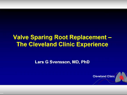 Valve sparing root replacement - Cleveland Clinic experience Valve sparing root replacement - Cleveland Clinic experience