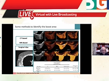 Variability in target volumes and organ at risk contouring in breast cancer radiation Variability in target volumes and organ at risk contouring in breast cancer radiation
