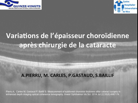 Variations de l'épaisseur choroïdienne 2015