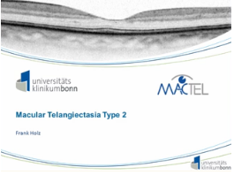 Pathologies Vasculaires - Télangiectasie maculaire Pathologies Vasculaires - Télangiectasie maculaire
