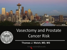 Vasectomie et cancer de la prostate : le développements récents, une analyse critique Vasectomie et cancer de la prostate : le développements récents, une analyse critique