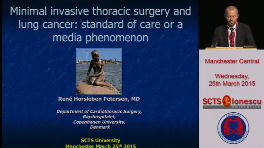 VATS lobectomy overview