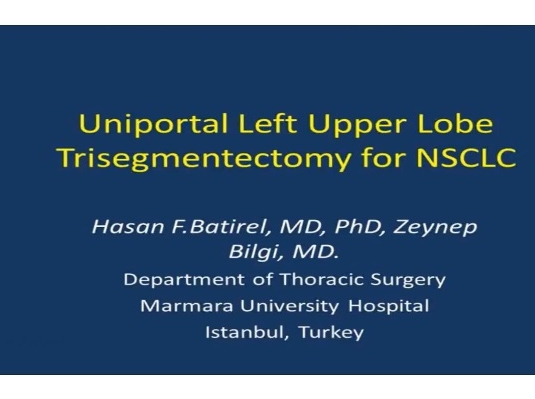 VATS Uniportal Left Upper Lobe Trisegmentectomy for NSCLC