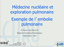Ventilation et perfusion pulmonaire