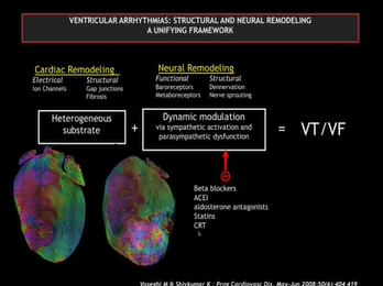 Ventricular Arrhythmias in Non-ischemic Cardiomyopathy