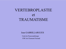 Vertébroplastie des fractures vertébrales post traumatiques