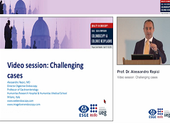 Vidéos : Challenge de la polypectomie en utilisant la résection endoscopique de la muqueuse (EMR) Vidéos : Challenge de la polypectomie en utilisant la résection endoscopique de la muqueuse (EMR)
