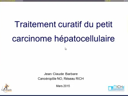 videofr/2015/2015-SNFGE/Traitement_curatif_du_petit_CHC-Jean-Claude_BARBARE.mp4 videofr/2015/2015-SNFGE/Traitement_curatif_du_petit_CHC-Jean-Claude_BARBARE.mp4