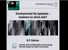 videoue/2014/2014_EFORT/Courses/Developmental_hip_dysplasia_treatment_on_which_side_K_P_Günther.mp4