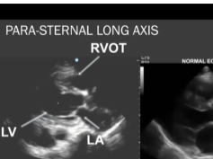 Virtual FTS Adult Session: Critical Care Ultrasonography Virtual FTS Adult Session: Critical Care Ultrasonography