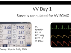 Virtual FTS Adult Session: Overview of ECMO Virtual FTS Adult Session: Overview of ECMO