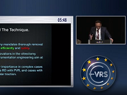 Vitrectomy Under Air: Technique, Advantages & Disadvantages