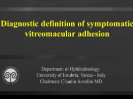 Troubles Vitréomaculaires - Diagnostic et symptomes de l'adhésion vitréomaculaire Troubles Vitréomaculaires - Diagnostic et symptomes de l'adhésion vitréomaculaire
