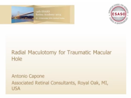 Troubles Vitréomaculaires - Maculopathie radiale pour le trou maculaire traumatique Troubles Vitréomaculaires - Maculopathie radiale pour le trou maculaire traumatique