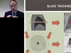 VolumeRAD Digital Tomosynthesis: Breakthrough tech improving lung nodule detection VolumeRAD Digital Tomosynthesis: Breakthrough tech improving lung nodule detection