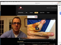 VR abscess and cultures question