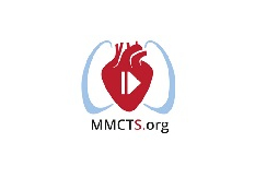 Warden procedure for correction of sinus venosus atrial septal defect