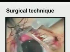 Webinar By Dr A K Grover