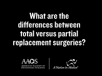 What are the differences between total versus partial replacement surgeries? What are the differences between total versus partial replacement surgeries?