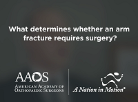 What determines whether an arm fracture requires surgery? What determines whether an arm fracture requires surgery?
