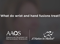 What do wrist and hand fusions treat? What do wrist and hand fusions treat?