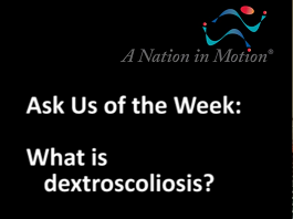 What is dextroscoliosis? What is dextroscoliosis?