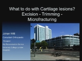 Que faire avec des lésions du cartilage? Excision - Recadrage - Microfracturation Que faire avec des lésions du cartilage? Excision - Recadrage - Microfracturation