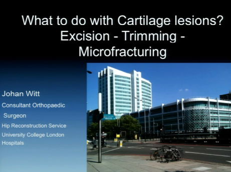 What to do with cartilage lesions? Excision - Trimming - Microfracturing