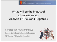 What will be the impact of sutureless valves: analysis of trials and registries What will be the impact of sutureless valves: analysis of trials and registries
