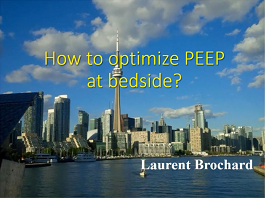 What's new in ARDS ?