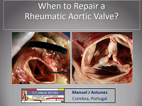 When to repair a rheumatic Aortic Valve