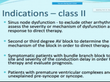 Why EP study should be done ?