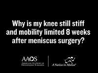 Why is my knee still stiff and mobility limited 8 weeks after meniscus surgery? Why is my knee still stiff and mobility limited 8 weeks after meniscus surgery?