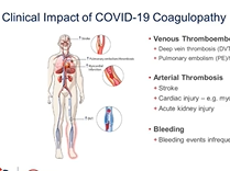 World Thrombosis Day 2020 Global Webinar