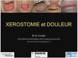 Xérostomie et douleur