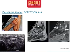 Zoom sur : Les articulations Zoom sur : Les articulations